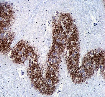 Synaptophysin Antibody