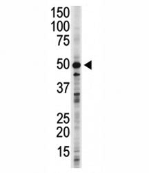 GSK3B antibody used in western blot to detect GSK3B in 293 cell lysate. Predicted molecular weight ~