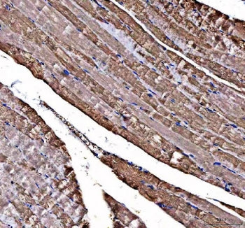 DOK7 Antibody / Docking protein 7