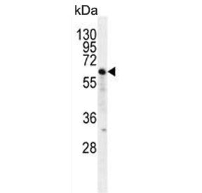 NKD2 Antibody / Naked-2