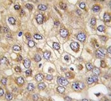 Claudin 2 Antibody (CLDN2)