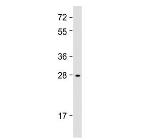 IGFBP1 Antibody (Center Region)