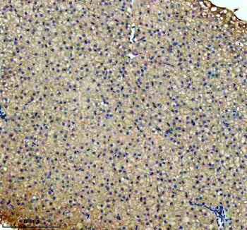 IHC staining of FFPE zebrafish liver tissue with Zebrafish Cbs antibody. HIER: boil tissue sections