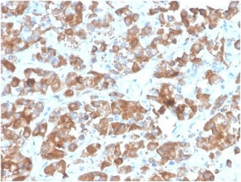IHC staining of FFPE human pituitary tissue with LH beta antibody (clone rLHb/1613). HIER: boil tiss