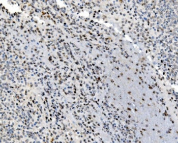 IHC staining of FFPE human spleen tissue with JUNB antibody. HIER: boil tissue sections in pH8 EDTA