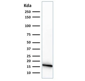 Western blot testing of human PANC-1 cell lysate with CELA3B antibody (clone CELA3B/1374).