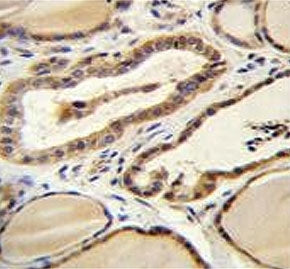 Retinal guanylyl cyclase 1 Antibody / GUCY2D