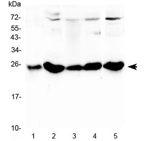 Western blot testing of 1) rat stomach, 2) rat liver, 3) mouse stomach, 4) mouse liver and 5) mouse