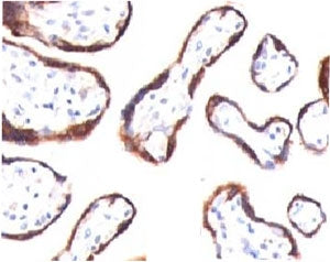 HCG-beta Antibody