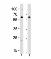 BMPR1A Antibody
