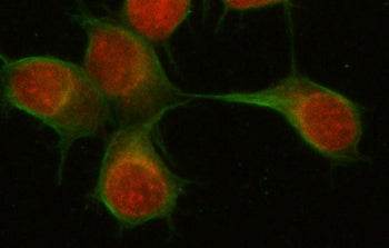 PSMD6 Antibody / 26S proteasome non-ATPase regulatory subunit 6
