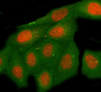 MNT Antibody / Max-binding protein MNT