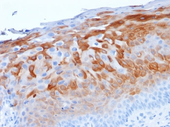 Cytokeratin 1 Antibody