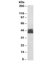 HLA-B Antibody