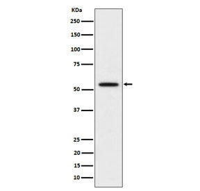 KATNA1 Antibody / Katanin p60 ATPase containing subunit A1