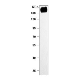 PREX2 Antibody / DEPDC2
