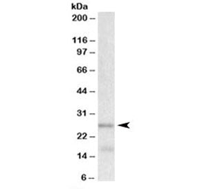 TPPP Antibody
