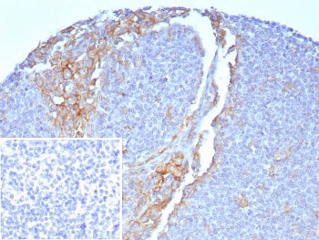 FCGR1A Antibody / CD64