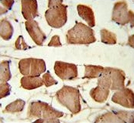 Aspa Antibody / Aspartoacylase