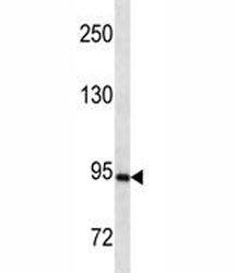 PR Antibody