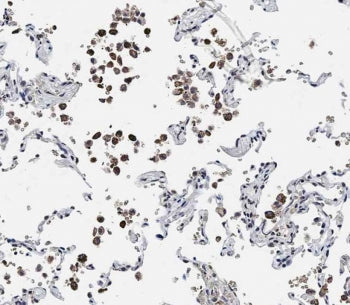 ADAMTS17 Antibody