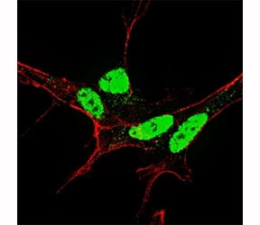 Fluorescent confocal image of SY5Y cells stained with p-NANOG antibody at 1:50. Immunoreactivity is