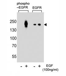 EGFR Antibody (phospho-Y1016)