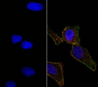 Right: Confocal Immunofluorescent analysis of SK-OV-3 cells using AF488-labeled EpCAM antibody (EGP4
