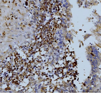 MMP9 Antibody