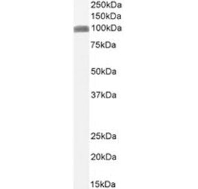 CSF1R Antibody