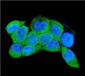 IRAK2 Antibody
