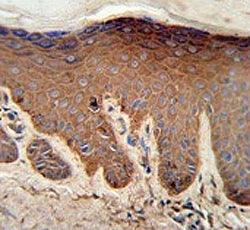 IHC testing of FFPE human skin tissue with Pyruvate Kinase PKM antibody. HIER: steam section in pH6