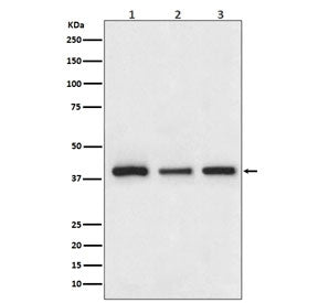Cathepsin Antibody / L-V-K-H