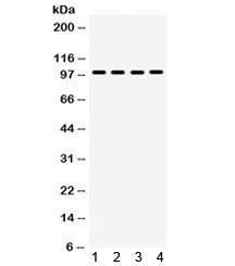 Western blot testing of 1) rat brain, 2) rat skeletal muscle, 3) human PANC and 4) mouse NIH3T3 lysa
