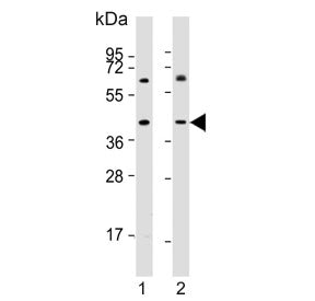 Galectin 8 Antibody / LGALS8