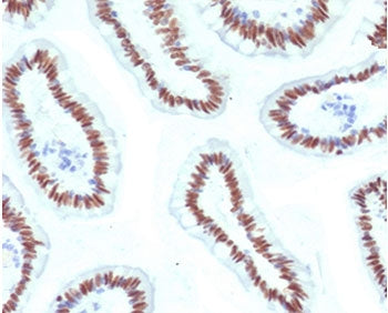 HNF1A Antibody