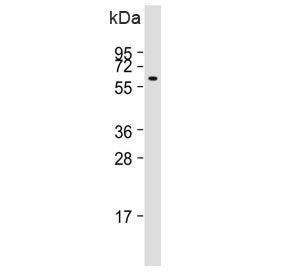 Western blot testing of human kidney lysate with PI4K2A antibody. Predicted molecular weight ~54 kDa