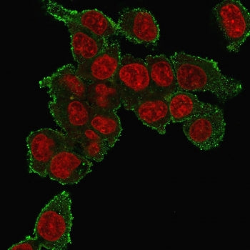TNF alpha Antibody