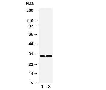 LASP1 Antibody