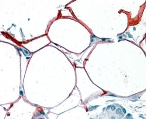 KIAA1881 Antibody