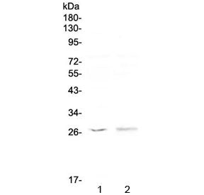 Kallikrein 6 Antibody / KLK6