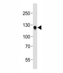 Western blot analysis of lysate from MCF-7 cell line using DDR1 antibody at 1:1000. Predicted molecu