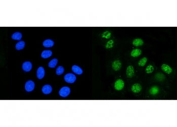Immunofluorescent staining of FFPE human MCF7 cells with DHODH antibody (green) and DAPI nuclear sta