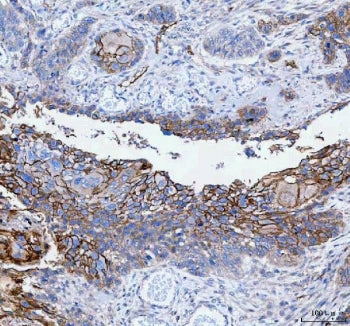 PALM Antibody / Paralemmin
