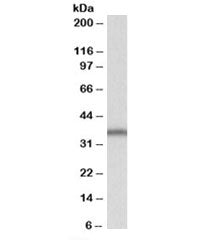 SLC9A3R2 Antibody (isoforms b & e)