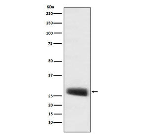 POMC Antibody / ACTH