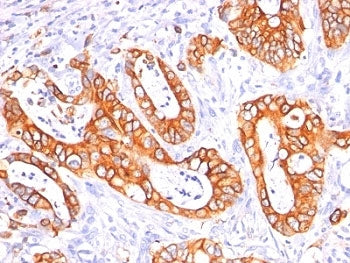 MUC1 Antibody / Mucin-1 Cocktail
