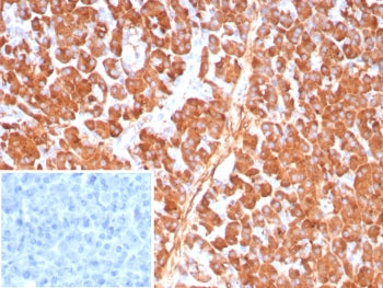 IHC staining of FFPE human pancreas tissue with Carboxypeptidase A1 antibody (clone CPA1/8784). Inse