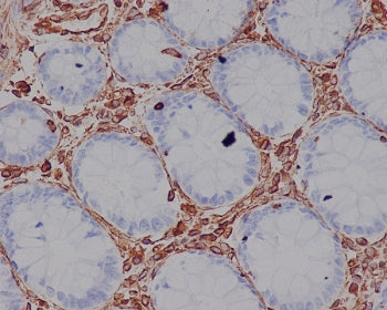 Vimentin Antibody