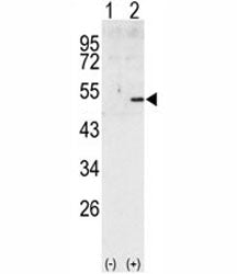 Cyclin A2 Antibody (CCNA2)